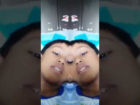 Hazeeq, Audy musically baby shark