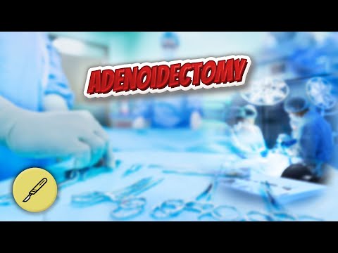 Adenoidectomy - Everything Surgeries ✅😬⁉️