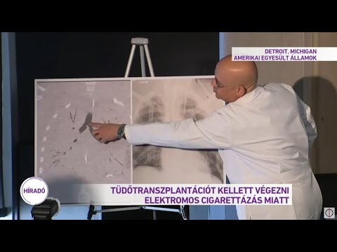 videó, hogyan lehet gyorsan leszokni a dohányzásról