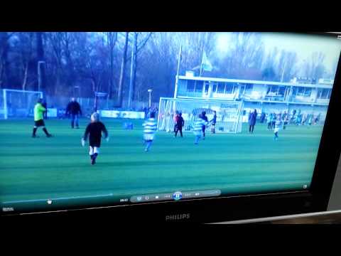 Dvc f1 dilano buitenkant voet.