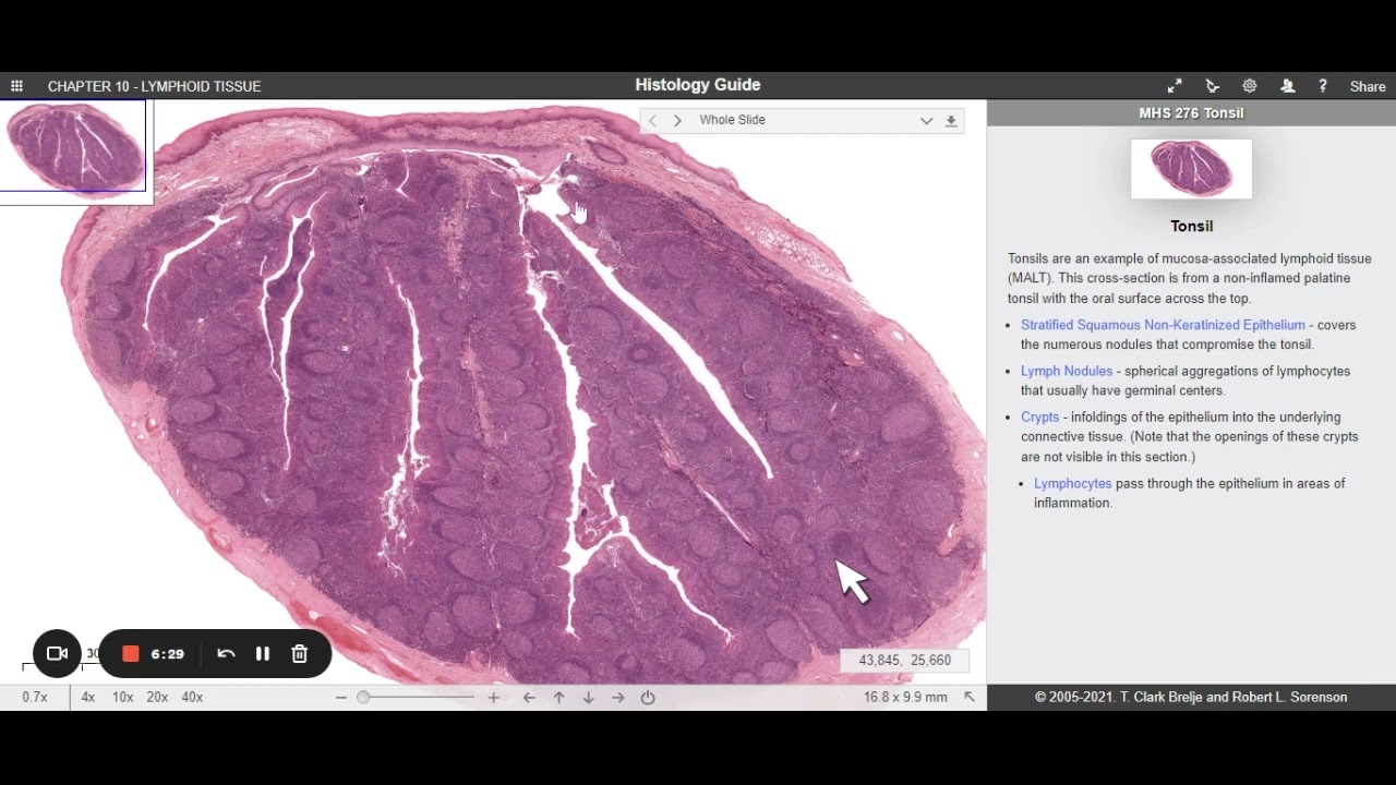 Aula | Histologia da Tonsila Palatina | Histology Guide