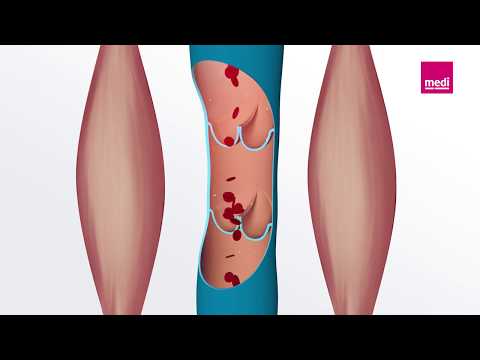 So funktionieren die Venenklappen | Ein Blick ins Innere des Venensystems