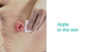 Product video: Coloplast Brava Skin Barrier Spray and Wipes