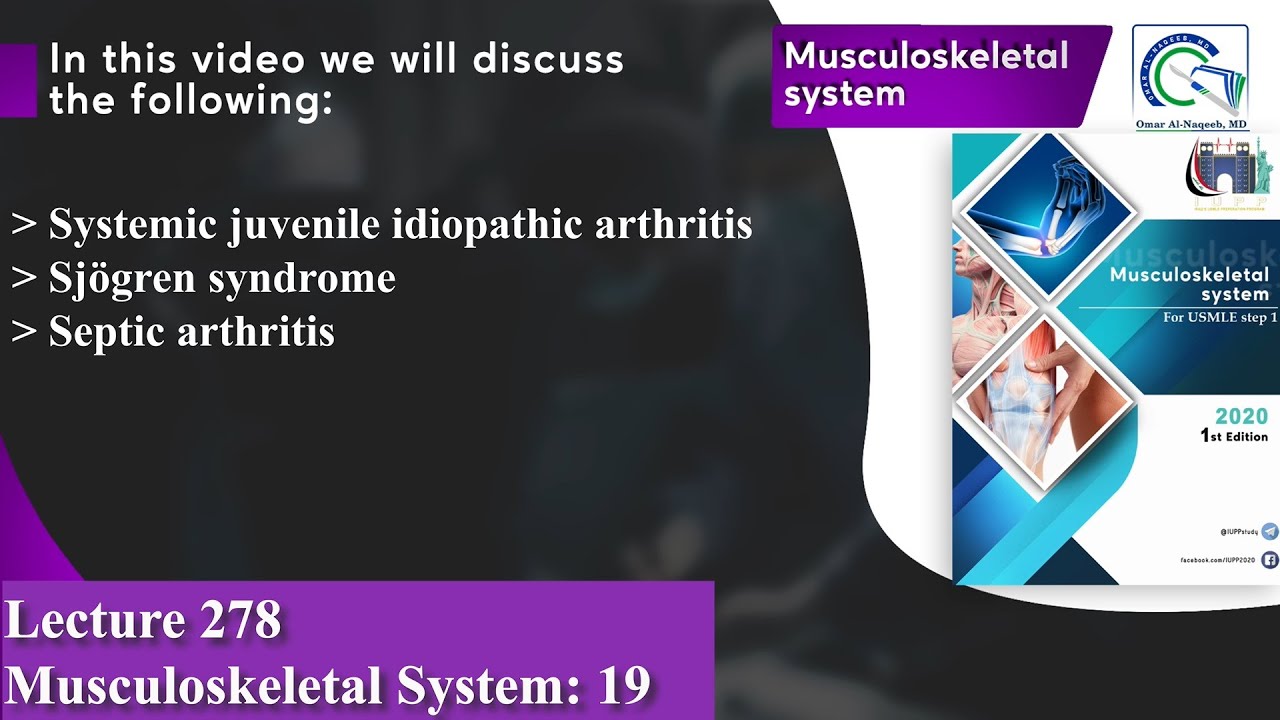 Systemic juvenile idiopathic arthritis | Sjögren syndrome | Septic arthritis