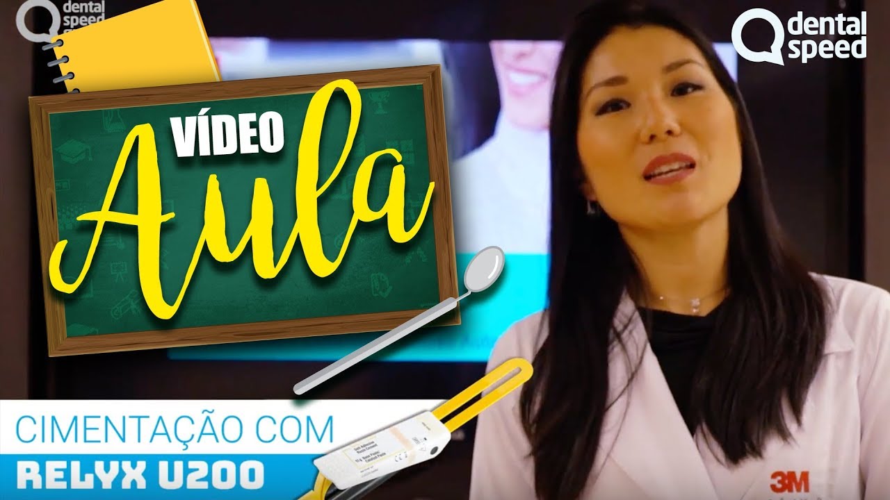 Cimentação com RelyX U200 da 3M - Dental Speed
