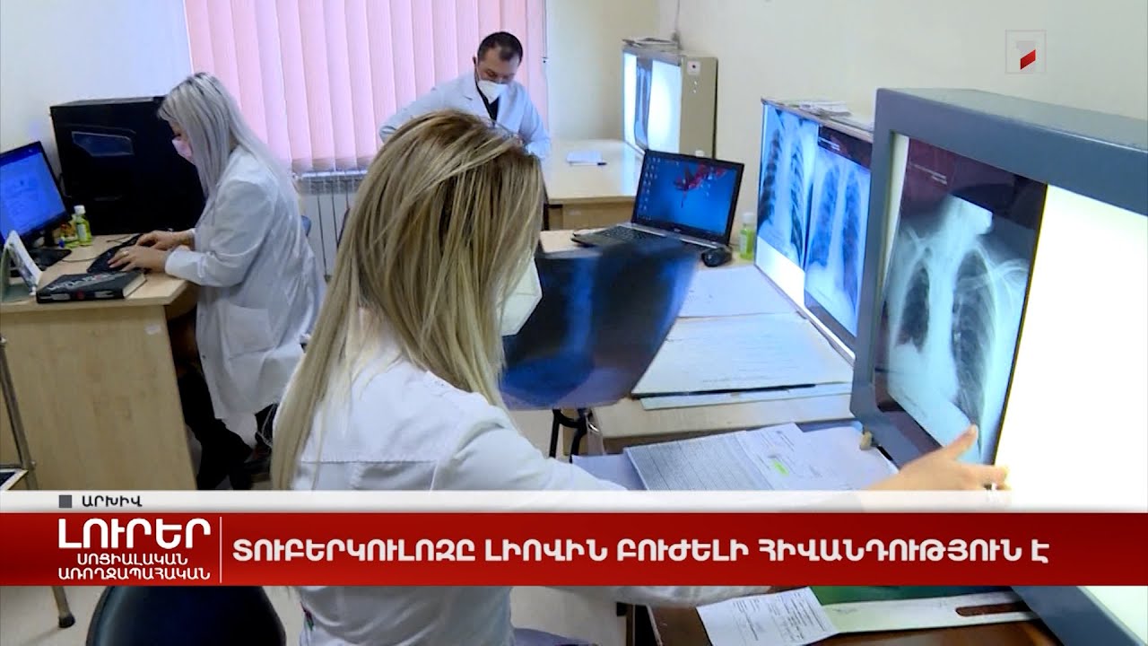 Տուբերկուլոզը լիովին բուժելի հիվանդություն է