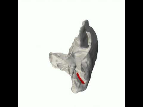 Mastoid notch of temporal bone   animation04