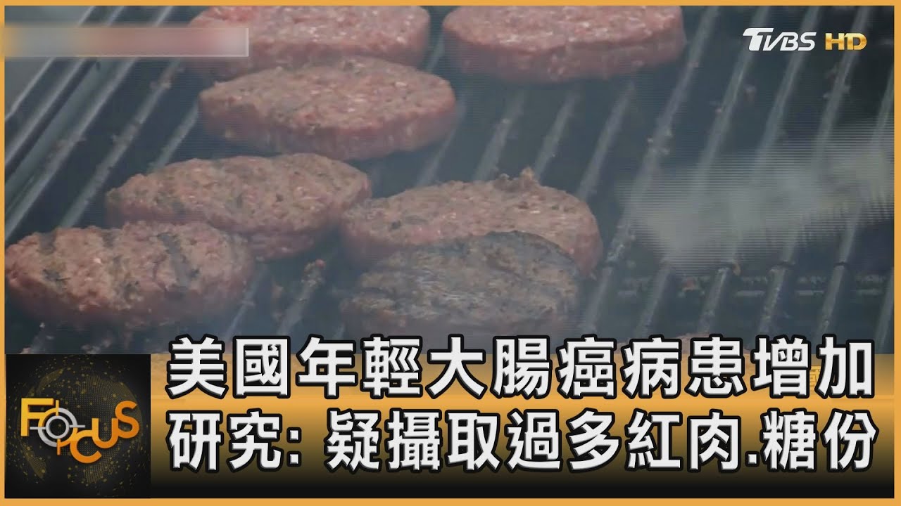 美國年輕大腸癌病患增加 研究:疑攝取過多紅肉.糖份