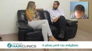 Αποκατάσταση μαλλιών με Advanced FUE - Δρ.Αναστάσιος Βεκρής