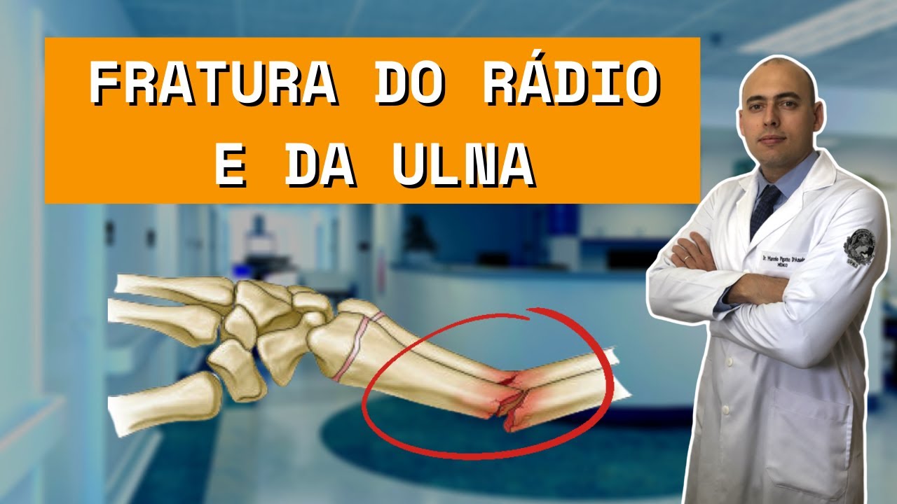 FRATURA RÁDIO E ULNA | SAIBA COMO É O TRATAMENTO