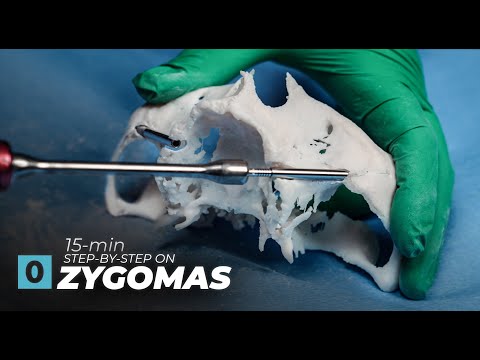 15 Minute Zygoma Class - ArchX