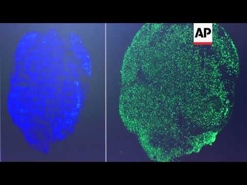 Psychedelic tea may have medicinal benefits