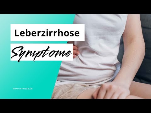 Liver cirrhosis: These are typical symptoms