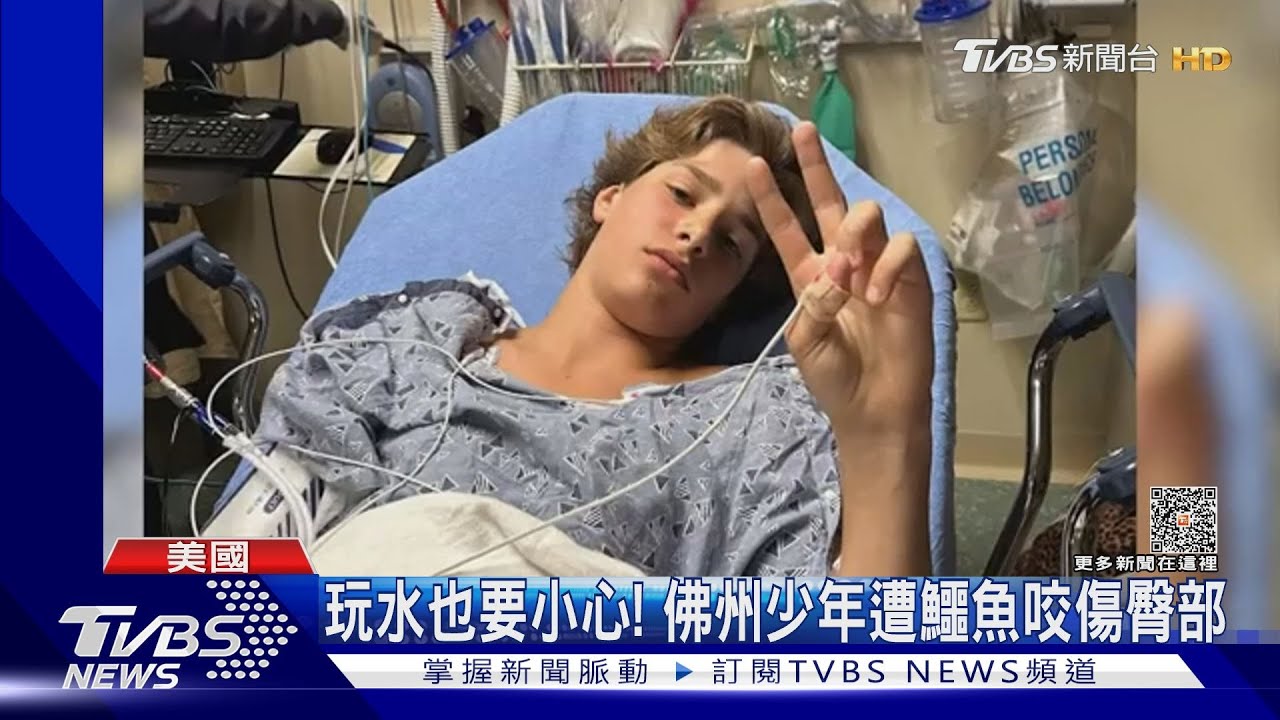 美國「鱷」勢力!南卡鱷魚追戲水人、佛州鱷魚咬少年臀