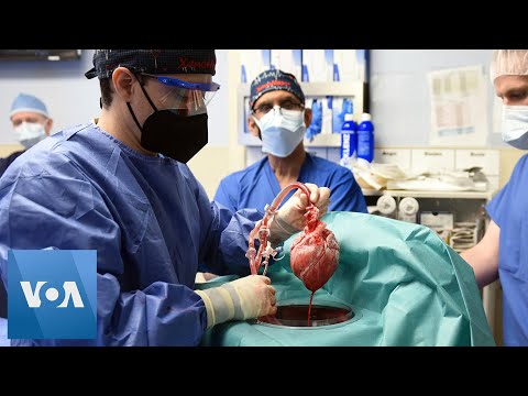 Doctors Transplant Pig Heart into Human for 1st Time