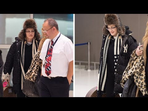 The face of the Madonna is not moving after the regular plastics