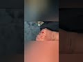 Ducky Bhai Dog Bite Ducky Bhai Attacked By Dog Shorts Duckybhai Desi Gabru Dog Bite Terry Dogbite