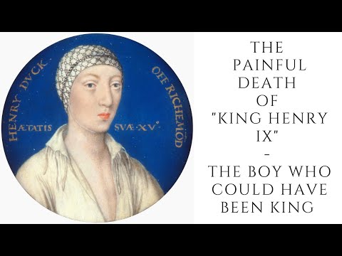 The PAINFUL DEATH Of "King Henry IX"  - The Boy Who Could Have Been King