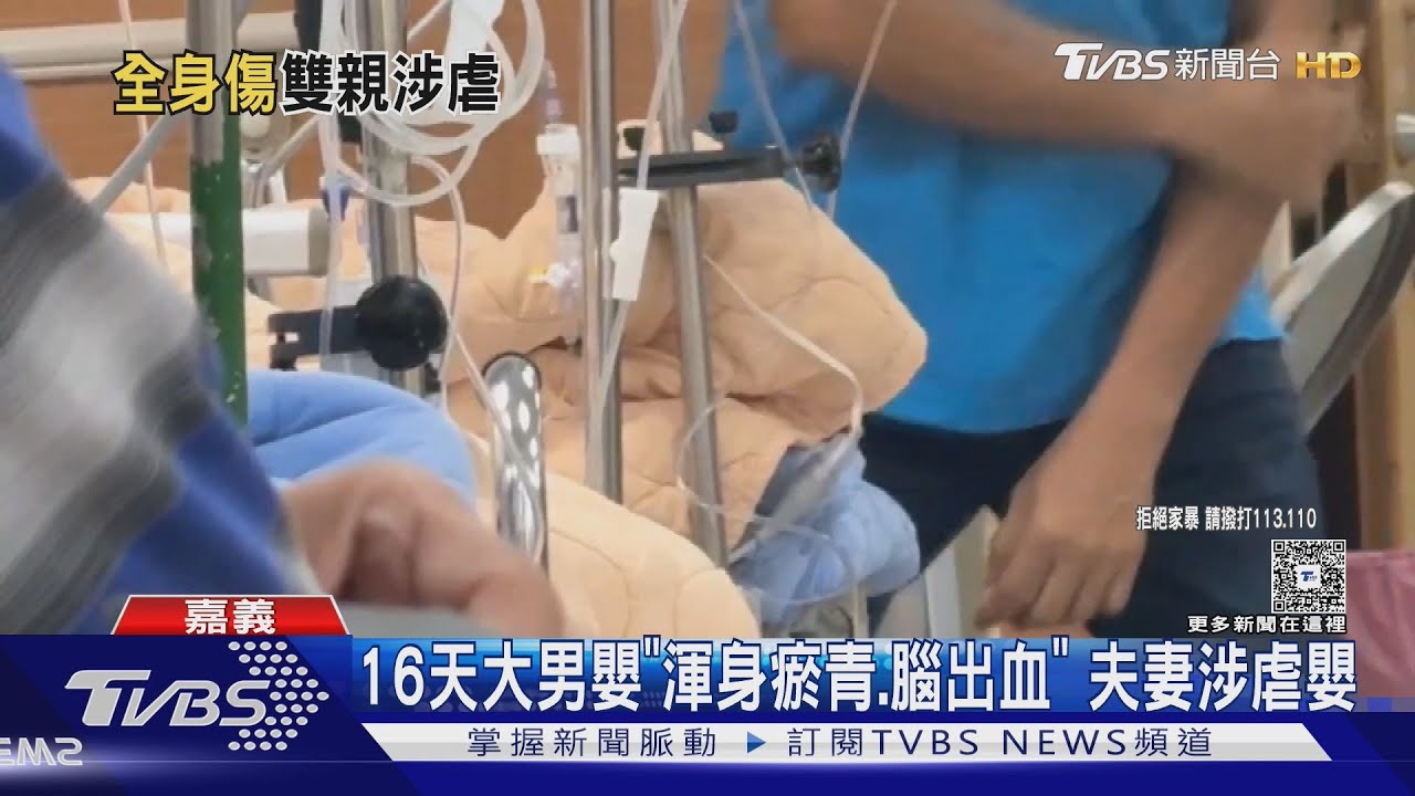 僅16天大男嬰「渾身瘀青、腦出血」　夫妻涉嫌虐嬰