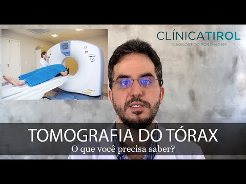 O que você precisa saber sobre Tomografia de Tórax!