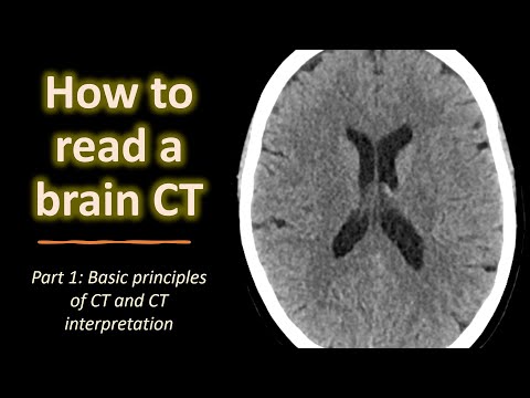 How to read a brain CT (part 1): Basic principles of CT and CT interpretation