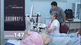 Գոյամարտ, Սերիա 147, Անոնս / Goyamart