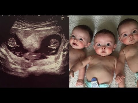Elle tombe enceinte🤰 de jumeaux 6 semaines 😲après la naissance de son premier enfant un miracle🥰 Video