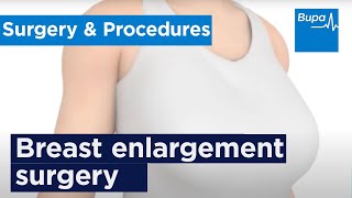 breast enlargments on Wife husband threesomes