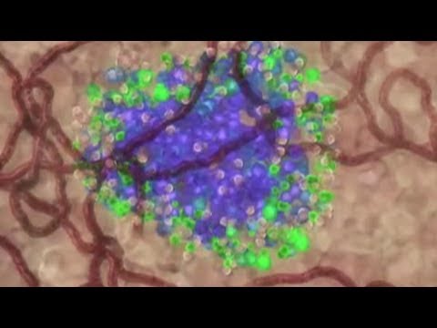 download lagu mp3 mp4 Common Vaccine Reverse Diabetes, download lagu Common Vaccine Reverse Diabetes gratis, unduh video klip Common Vaccine Reverse Diabetes