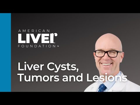 Ask the Experts: Liver Cysts, Tumors and Lesions