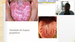 Situación 4 parte B ExFisico MPNA 2021