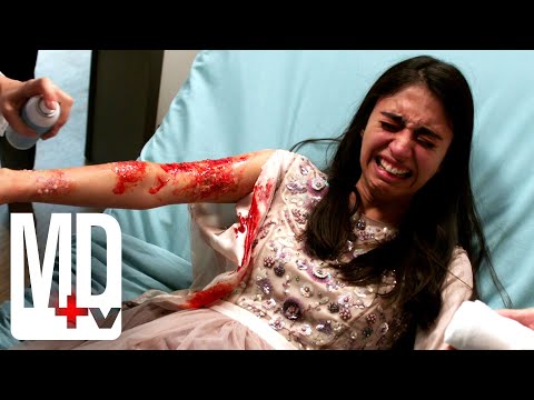 Patient CANNOT Touch Anything with her Skin | Pure Genius | MD TV