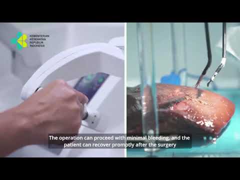 Sina Surgical System Video 2420