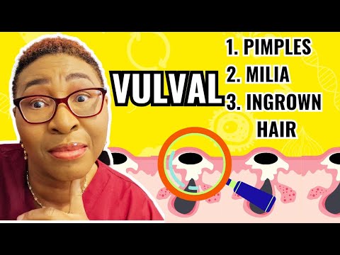 Stop Treating These 3 Vulval Lumps Wrong - Here's What Works