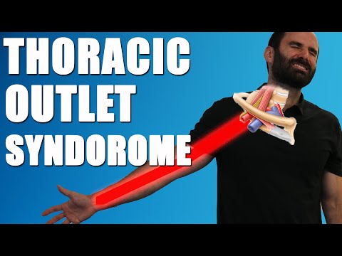 THORACIC OUTLET SYNDROME.  BEST Exercises, Stretches & Advice for Neck & Arm Pain Relief