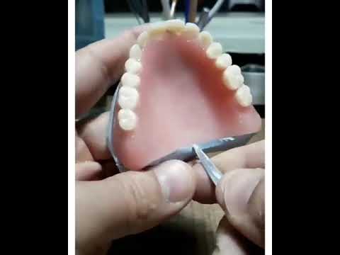 Broken Denture repair in 1 mimute😍 #denture #shorts