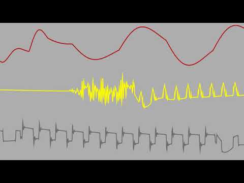 Commodore C64 SID - MARIO IS DEAD / MICHAL BRZESKI (MCH) & JAMMER