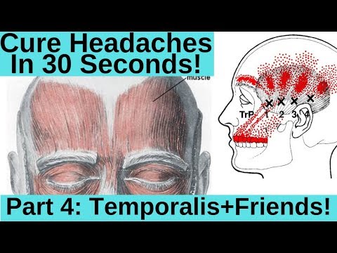How to cure headaches in 30 Seconds