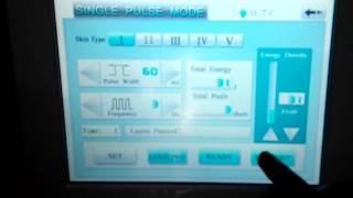 operation for diode laser venus No 1