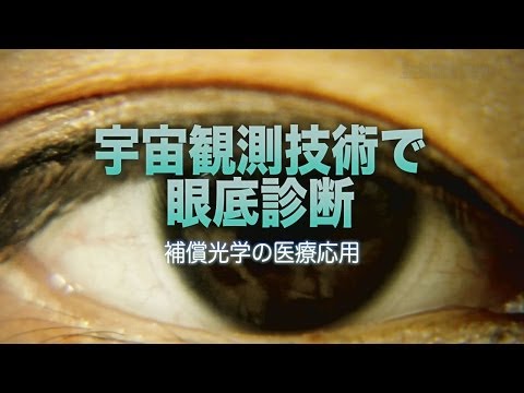 補償光学について詳しく解説