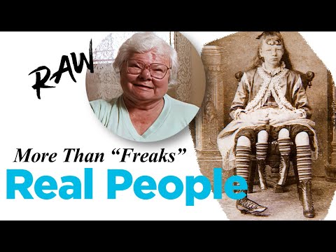 "No One is Normal" — The Half-Girl Breaks the Myth