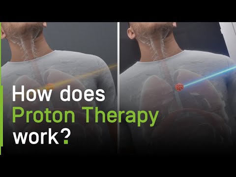 How Does Proton Therapy Work?