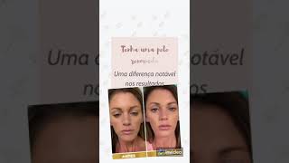 [cido hialurnico] funciona? #shorts