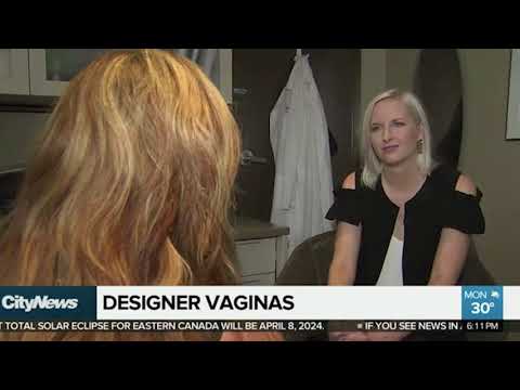 SpaMedica TV - CityNews Vagina - Labiaplasty
Video Thumbnail