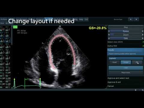 GE Vivid AFI 2 0 Demo