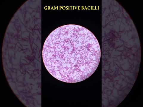 Gram positive bacilli #microscopy #view #shots