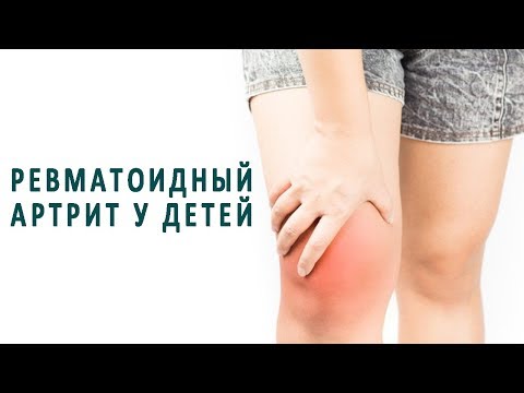 Боли в левой части груди и спины Боли в районе сердца при остеохондрозе