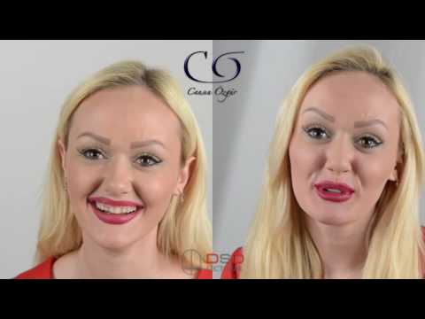 Digital Smile Design Kursu - Bomonti Hilton İstanbul