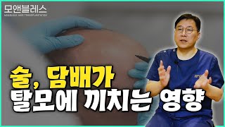 술&담배 탈모의 원인이 된다?