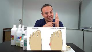 ¿Qué es el juanete de sastre y qué lo provoca